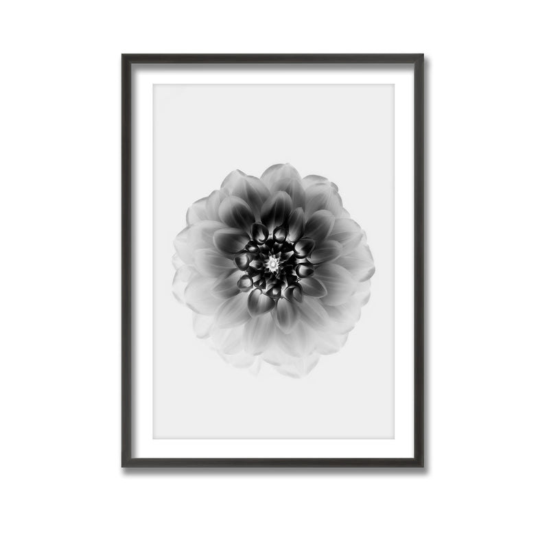 "X-Ray" Framed Print Wall Art
